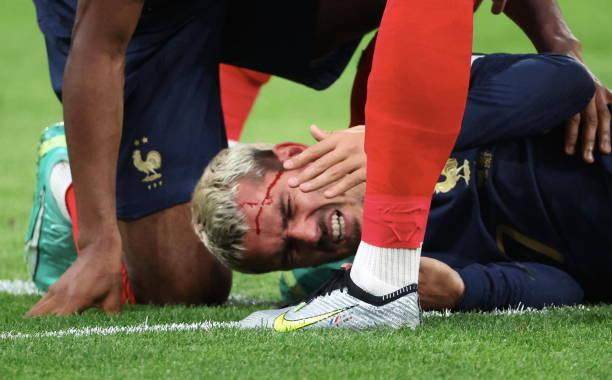 1687232305708055093.jpg 开云体育五大联赛-姆皇破法国纪录,54球平哈兰德!“小公主”挂哨抢戏